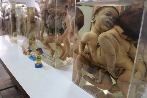 موزه پزشکی سیریراج در تایلند